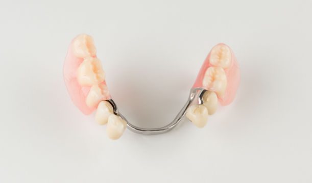 Partial Dentures On Table