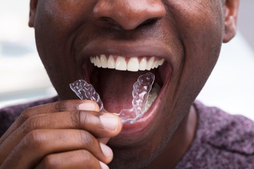 Mouth guard chewing