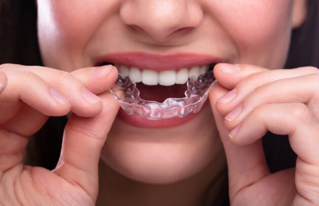 A woman putting a clear mouthguard into her mouth